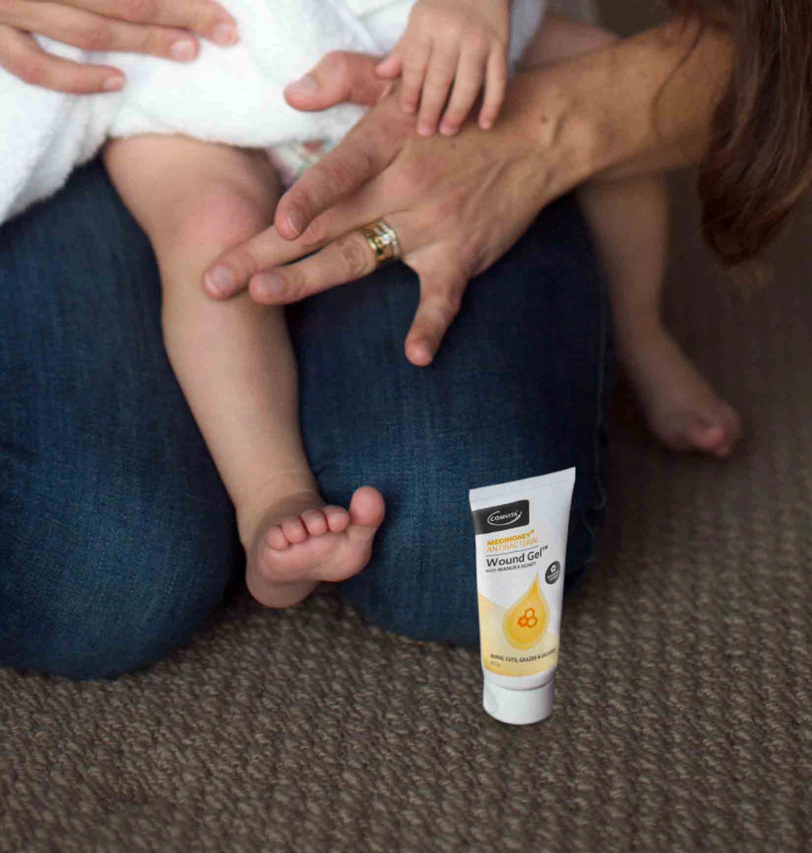 Parent putting MediHoney on a wound